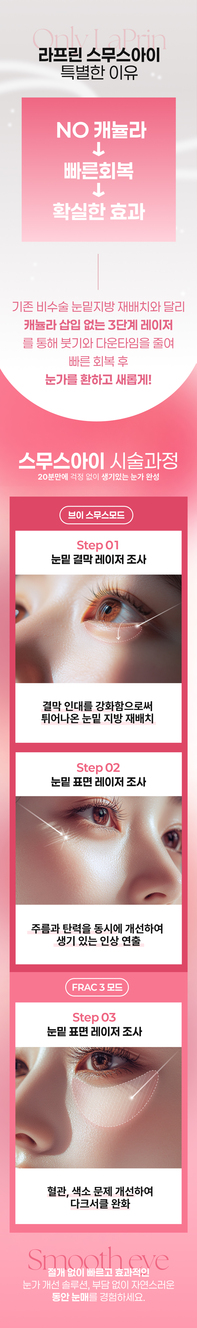 바비톡_스무스아이-랜딩-(수정)-(3)_03.jpg