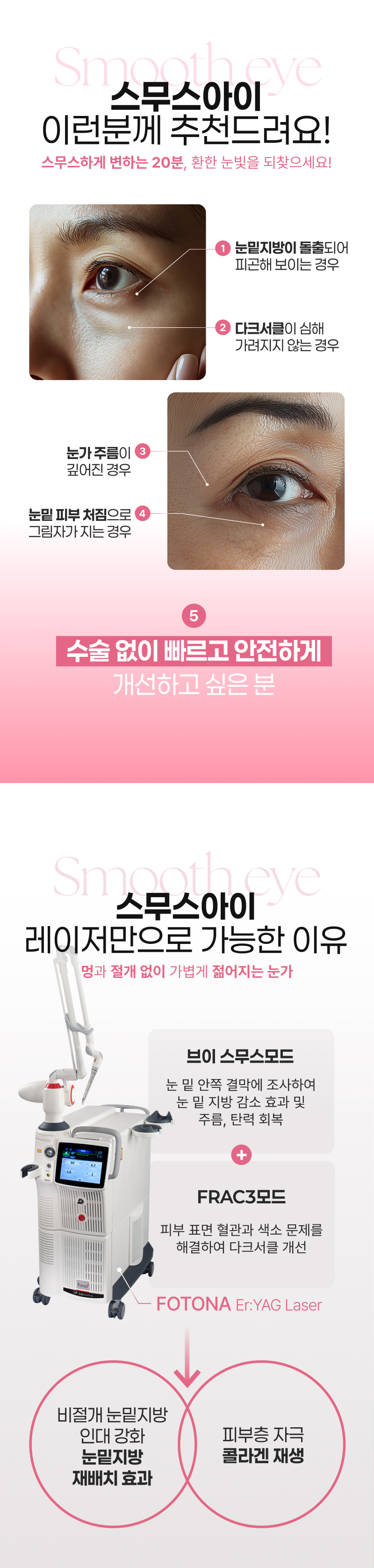 바비톡_스무스아이-랜딩-(수정)-(3)_02.jpg