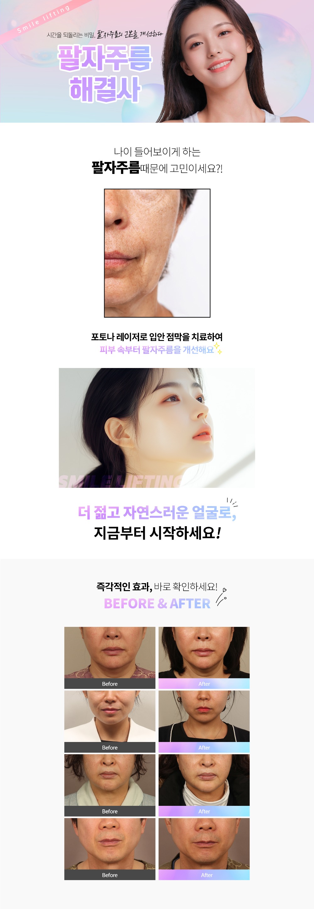 241118_스마일리프팅_pc_01.jpg