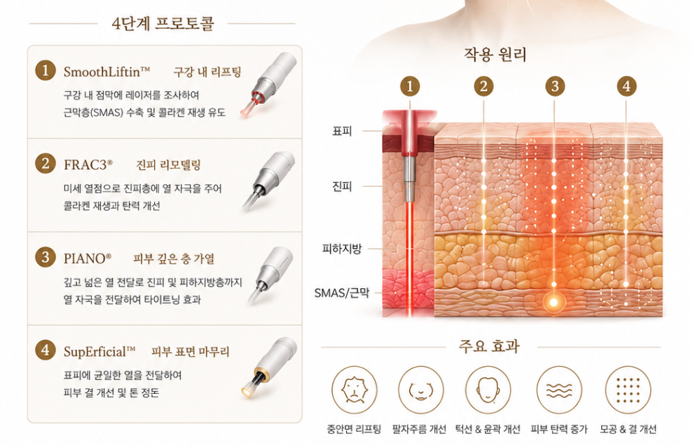 2번.png